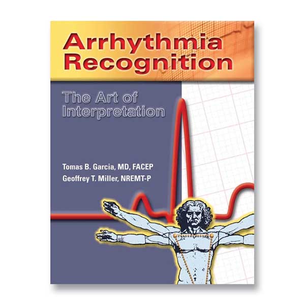Arrhythmia Recognition